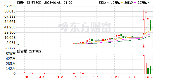 中国配资网 脑再生科技 上演美股“神话”